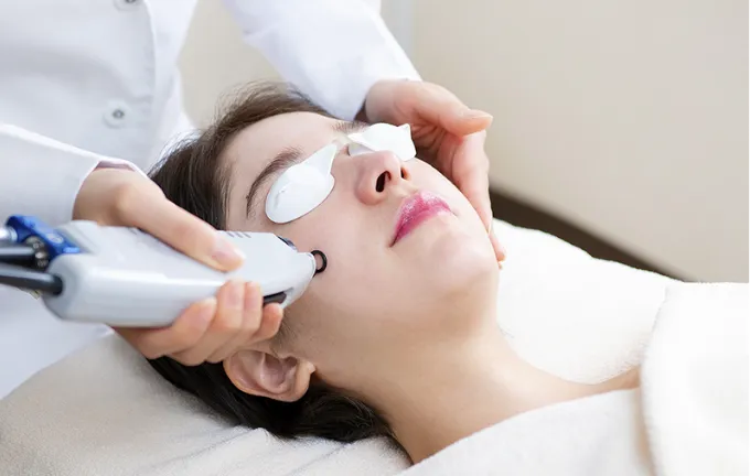 ニキビ跡赤み専用レーザー（VビームⅡ）